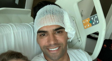 Falcao Garcia no hospital durante e recuperação da cirurgia no rosto - Reprodução/Instagram